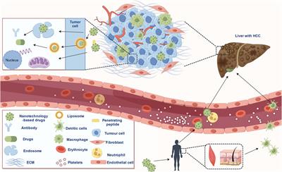 The improving strategies and applications of nanotechnology-based drugs in hepatocellular carcinoma treatment